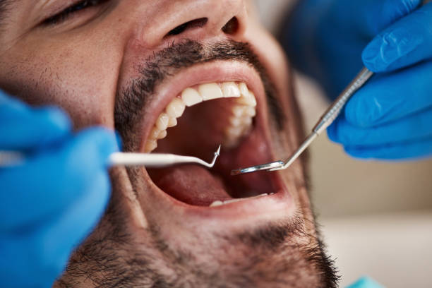 Professional Emergency Dentist in CA